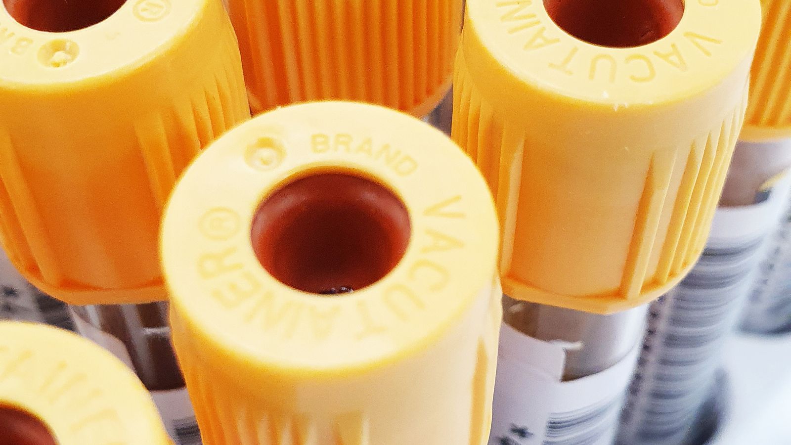 Close-up of blood collection vials with yellow caps arranged in a row.